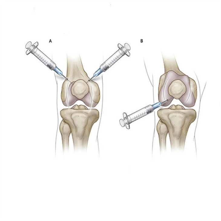 knee567